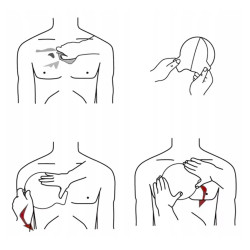 Opatrunek wentylowy okluzyjny ACS Chest Seal na rany klatki piersiowej1szt